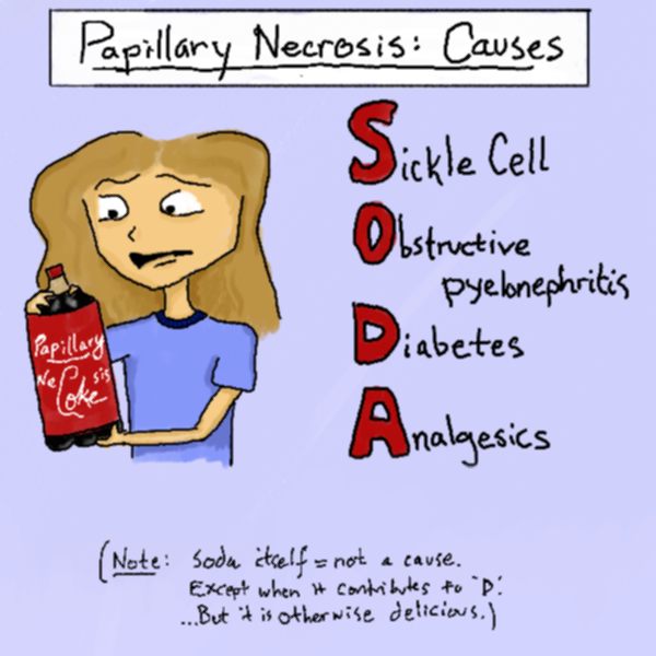 mnemonic